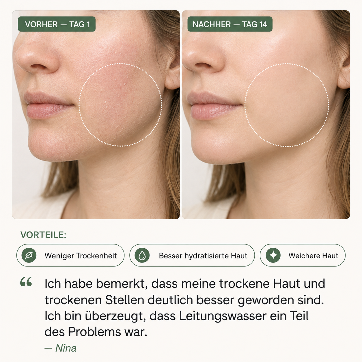 KLARA Gesichtsfilter für Skincare